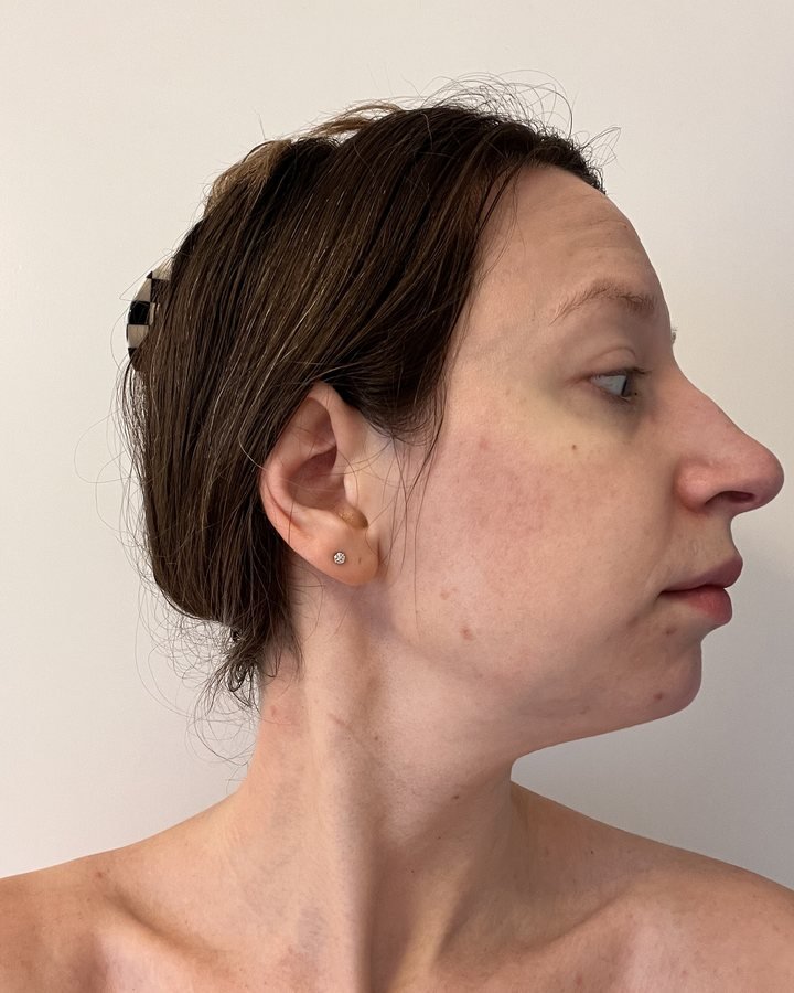 Day 30
